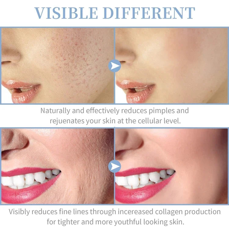 GlowPulse 4-in-1 High Frequency Wand